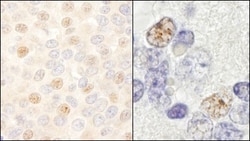 DDX46 Antibody, Novus Biologicals 0.1mL; Unlabeled:Antibodies, Polyclonal